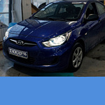 Установка Би-ксеноновых линз Hella 3 | Hyundai Solaris 2012 год